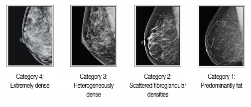 breast density images